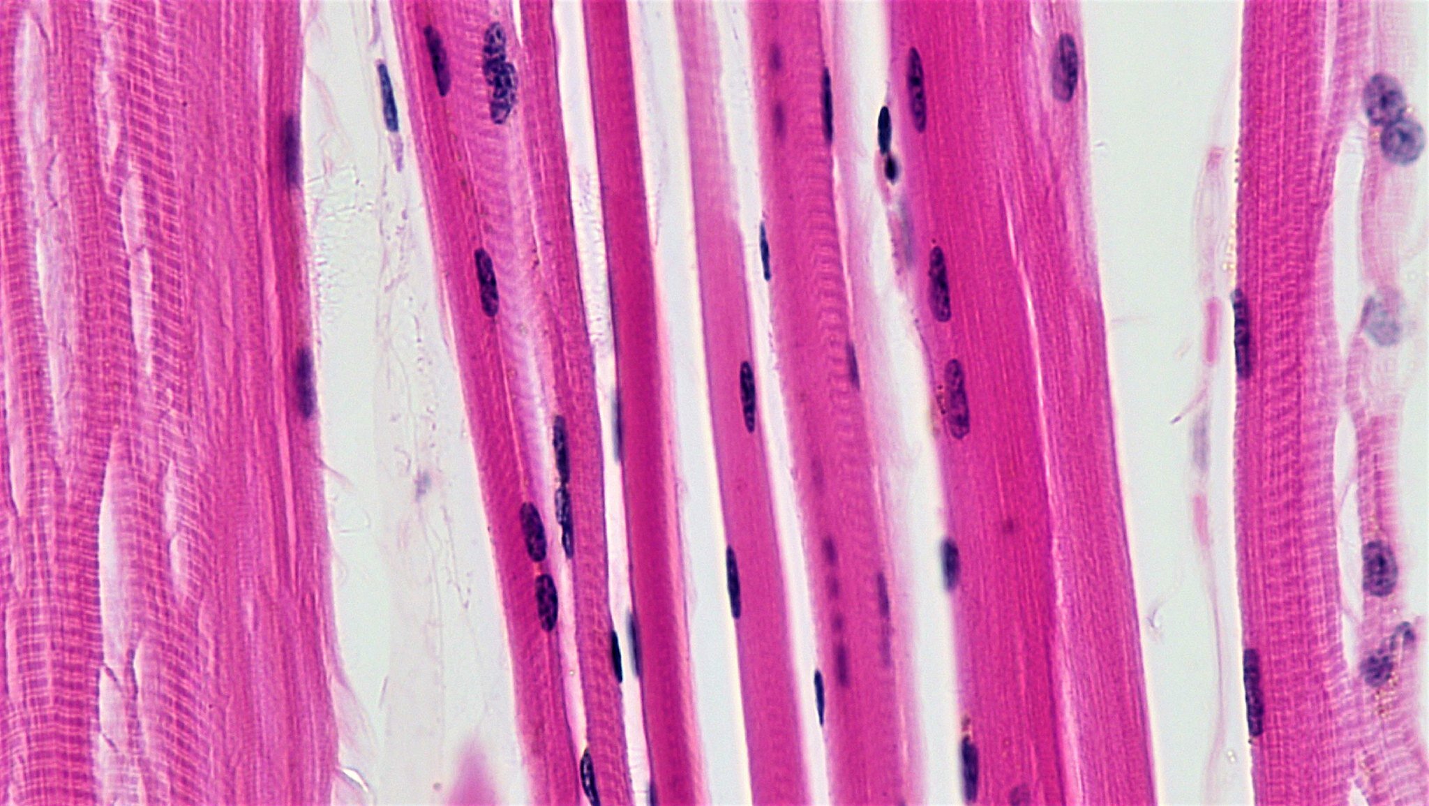 Featured image for "Unveiling the Atlas of Aging: Understanding and Combatting Muscle Weakness"