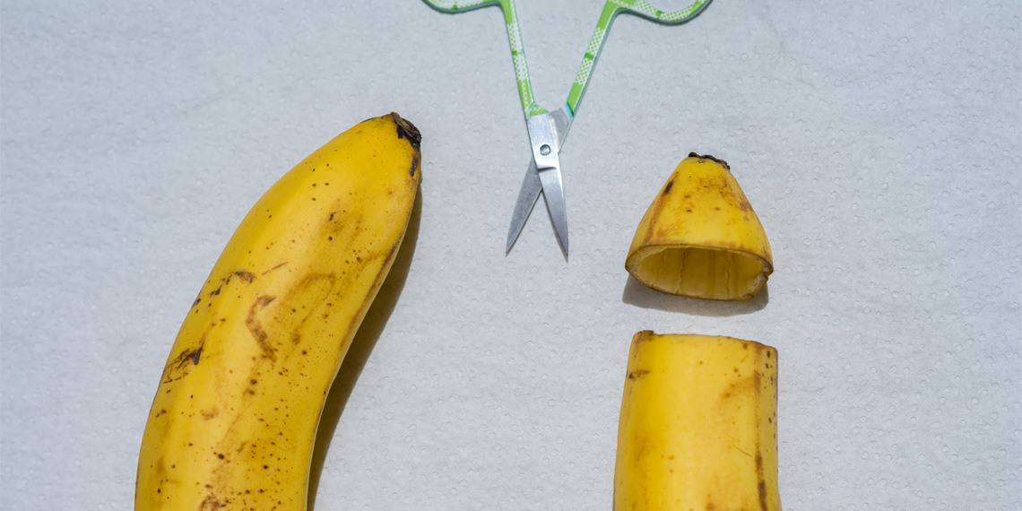 Featured image for Circumcision status not as important as happiness, study finds.