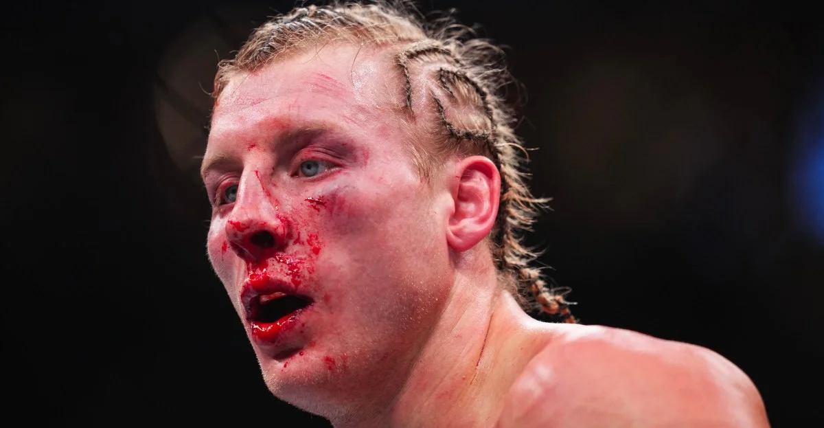 Pimblett jokes about making Gaethje's face look different after UFC 324 loss