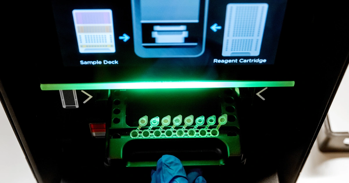 Featured image for Revolutionary DNA Test Diagnoses Complex Infections with Precision