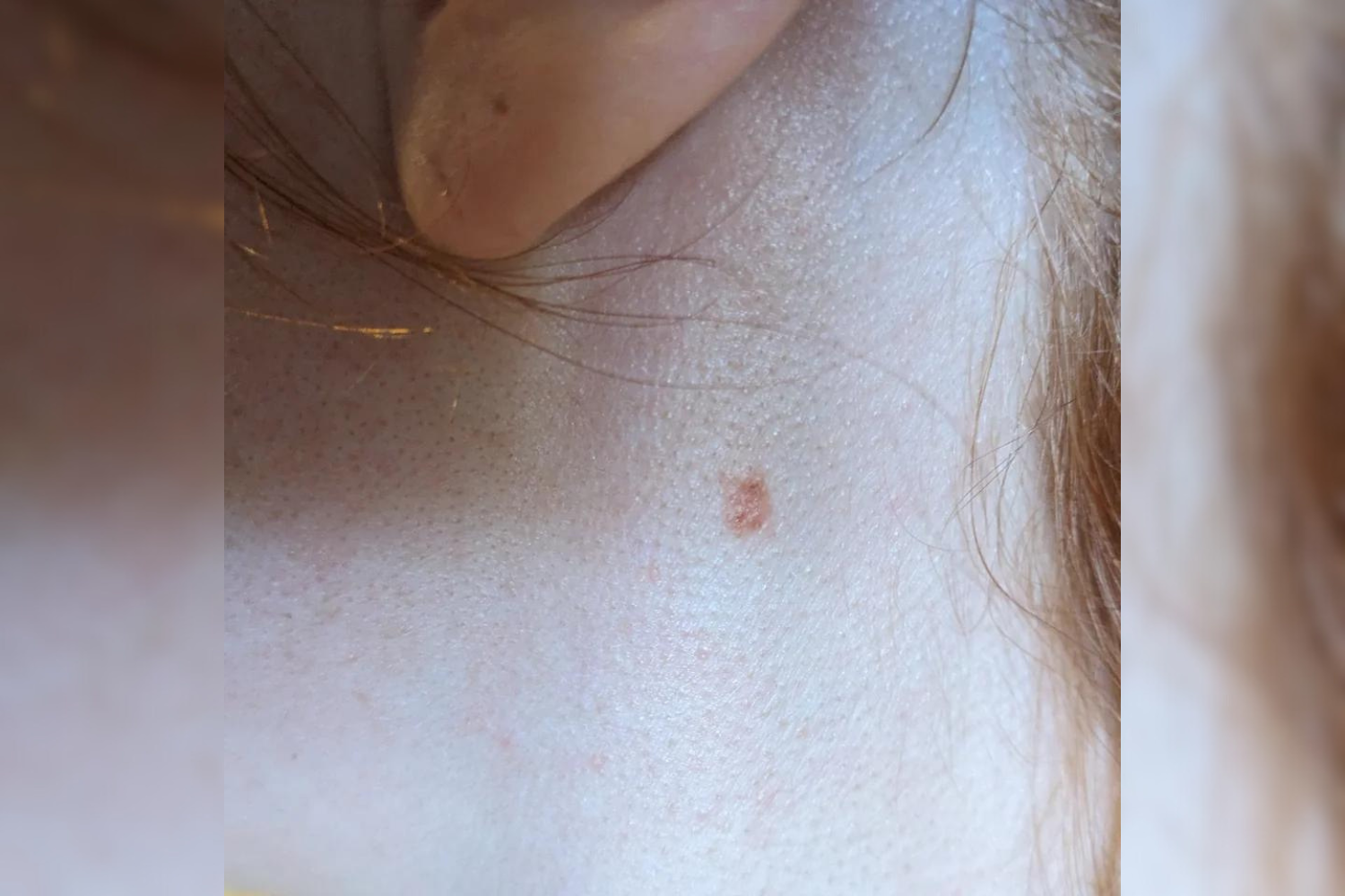 Featured image for The Power of Advocacy: How One Woman's Insistence on Tests Saved Her Life