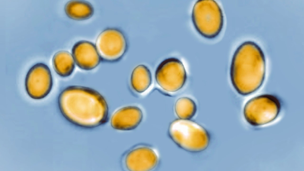 Rising Cases of Candida Auris Fungus in the US During Pandemic