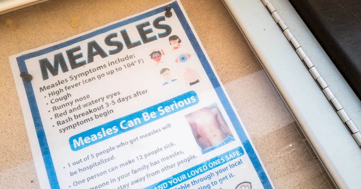 Measles Outbreak Prompts Vaccination Push in Kentucky