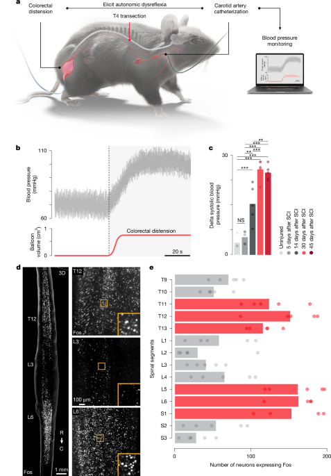 Featured image for Advances in Blood Pressure Regulation Post-Spinal Cord Injury Using ONWARD ARC-IM Therapy