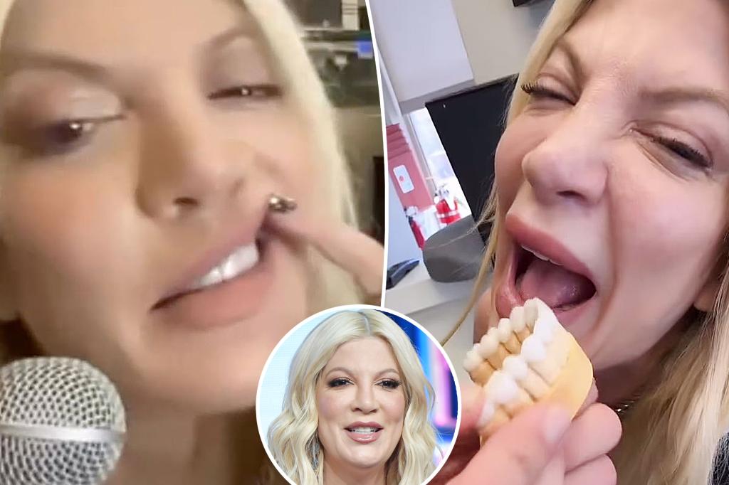 Featured image for Tori Spelling Finds Happiness with New Veneers After 'Disgusting' Teeth