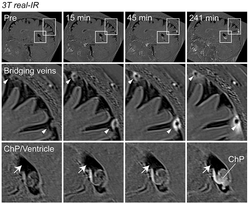 "Uncovering Direct Brain-Dura Connections and Waste Disposal Pathways"