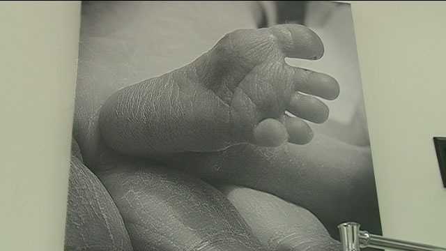 Featured image for "Addressing the Impact of Untreated STDs on Newborns in Post-Roe v. Wade Mississippi"