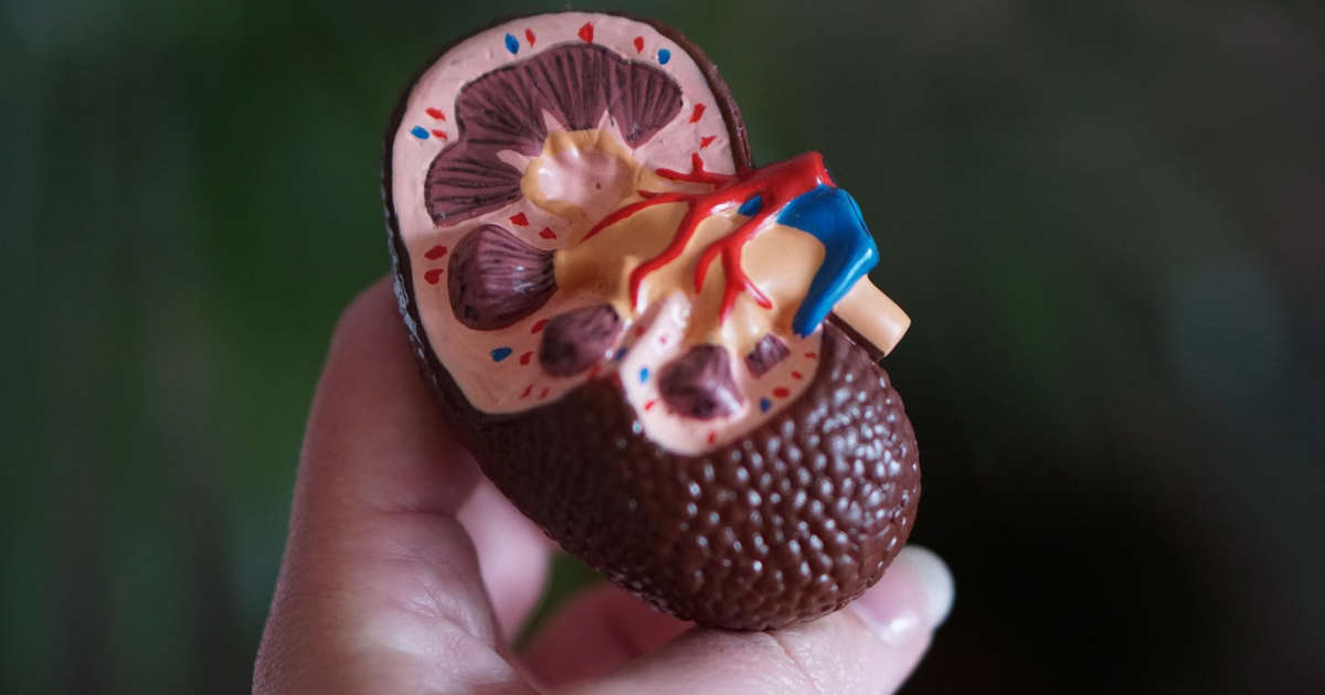 Featured image for Recurrent Nephrolithiasis in Cannabis Hyperemesis Syndrome: A Case Study