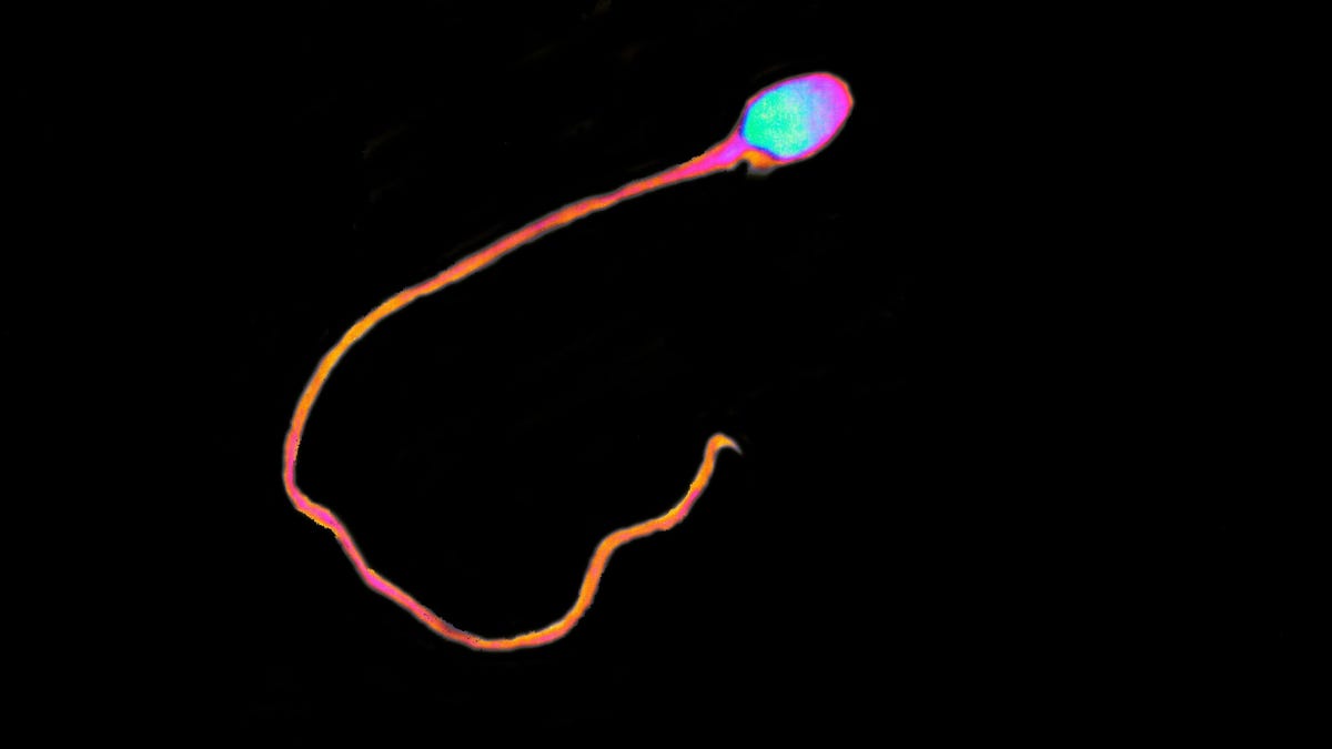 Featured image for "New Male Birth Control Gel Offers Fast, Reversible Contraception"