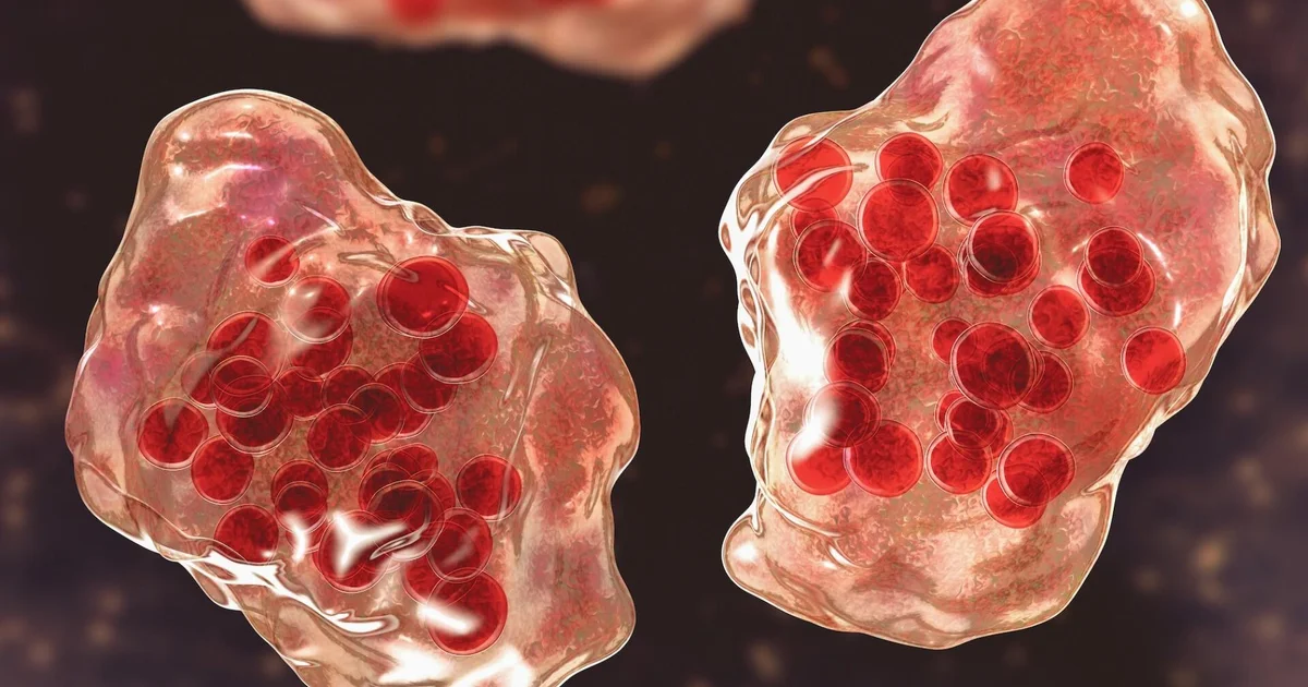 Child in Los Angeles Dies from Rare Measles-Related Complication