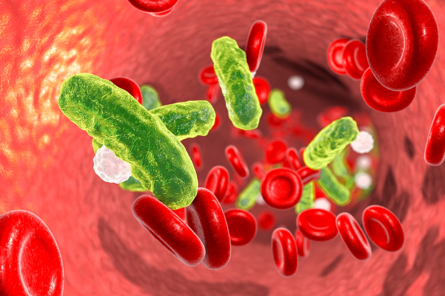 Featured image for "Prenosis AI Tool Receives FDA Approval for Sepsis Detection"
