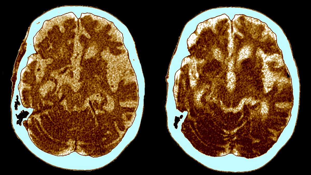 Featured image for "Human Brain Size Increases, but IQs Decline: A Modern Paradox"