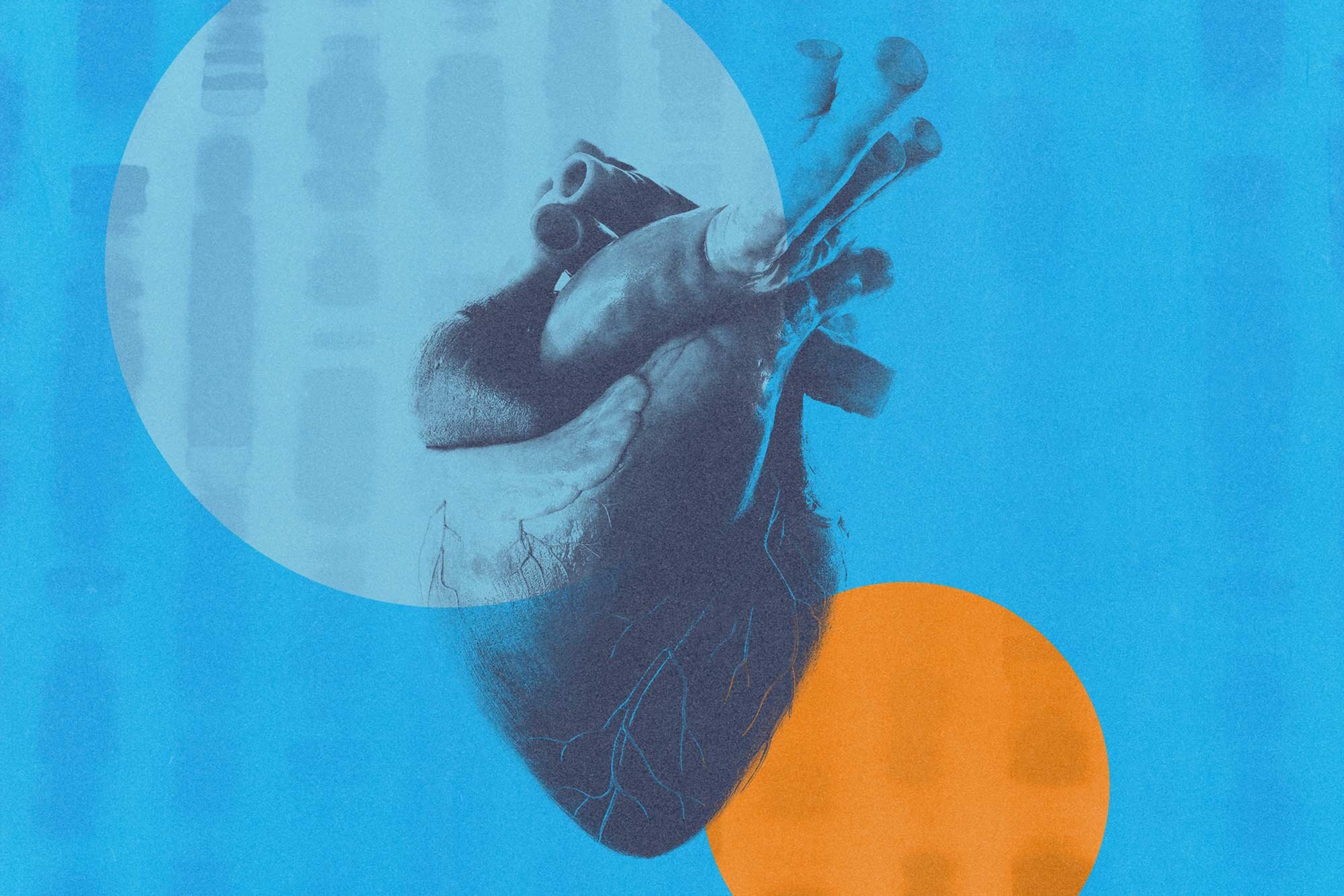 Featured image for "Unlocking the Path to Preventing Deadly Coronary Artery Disease through Gene Discoveries"