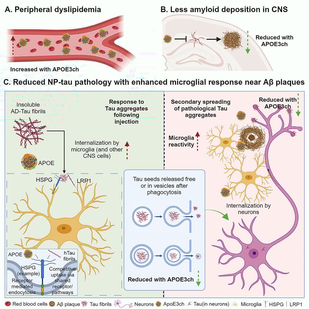 Featured image for Genetic anomaly reveals potential Alzheimer's prevention clues