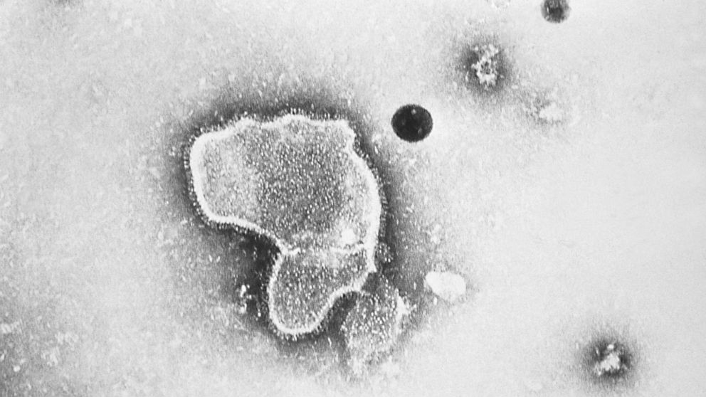 CDC Panel Recommends RSV Vaccine for Older Adults 60+