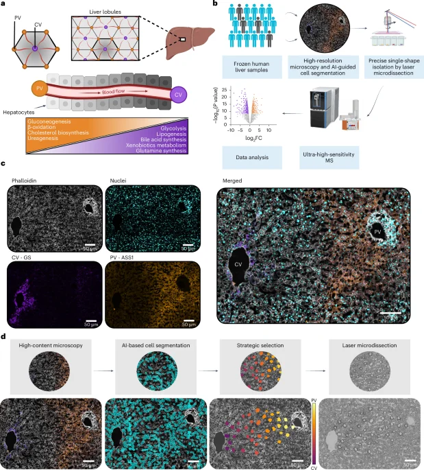Single-cell proteomics maps human liver zonation and its fragility in diseased tissue