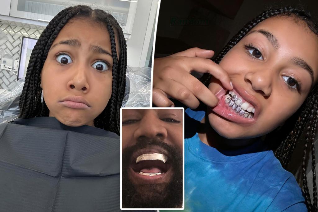Featured image for Kanye West and North West's Dazzling Dental Transformations: Diamond Grills and $850K Titanium Dentures