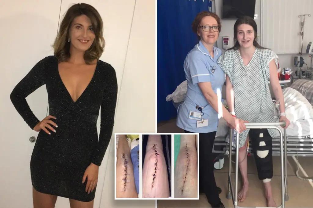 The Shocking Diagnosis After Knee Bones Shatter While Sitting on Toilet