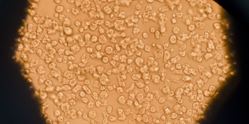 Featured image for "Rising Concerns Over Ancient 'Zombie' Viruses Resurfacing Due to Climate Change"