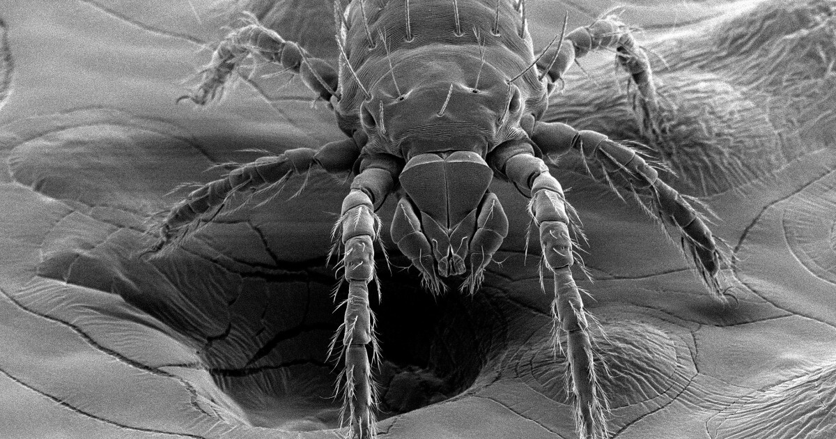 Featured image for Emerging Disease: Bacterium-Carrying Chiggers Found in North Carolina