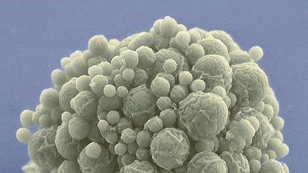 Featured image for "Artificial Cells Outpace Natural Ones in Evolutionary Race"