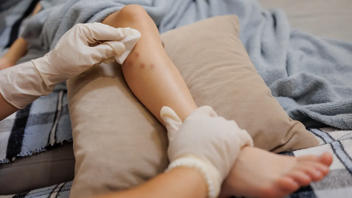 Featured image for Health officials warn of first-time virus detection and universal bite risk