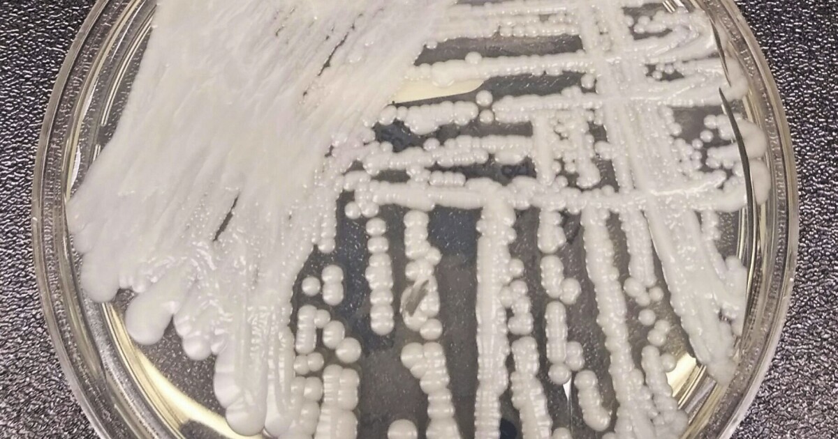 Featured image for The Deadly Spread of Candida Auris Fungus in the US.