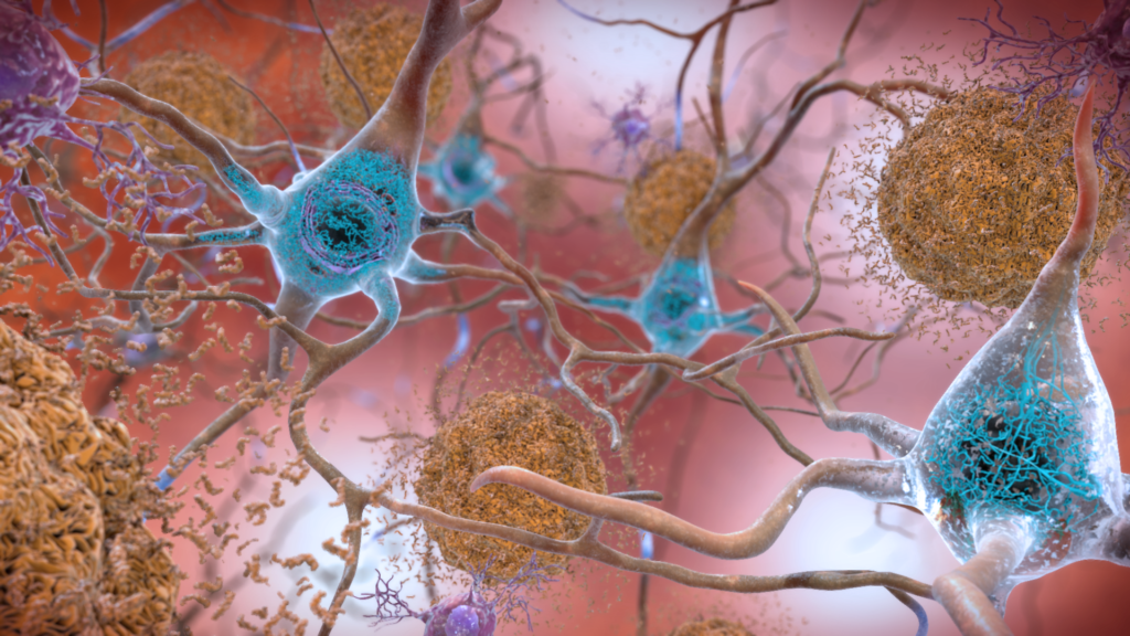 Featured image for "Promising Results: Biogen's Alzheimer's Drug Slows Cognitive Decline in Early Study"