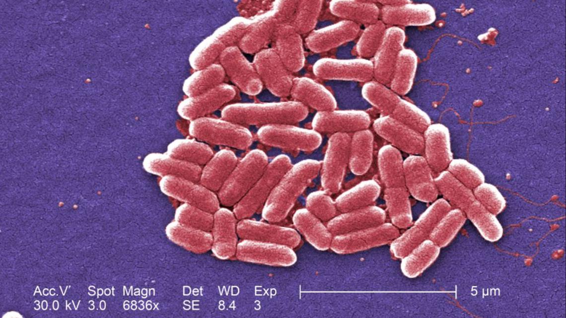 Featured image for Lettuce Cleared in St. Louis E. Coli Outbreak Investigation