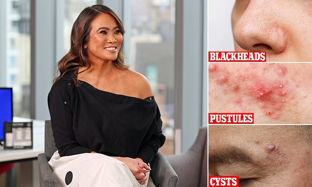 "Expert Tips and Products for Clearing Acne from Dr. Pimple Popper"