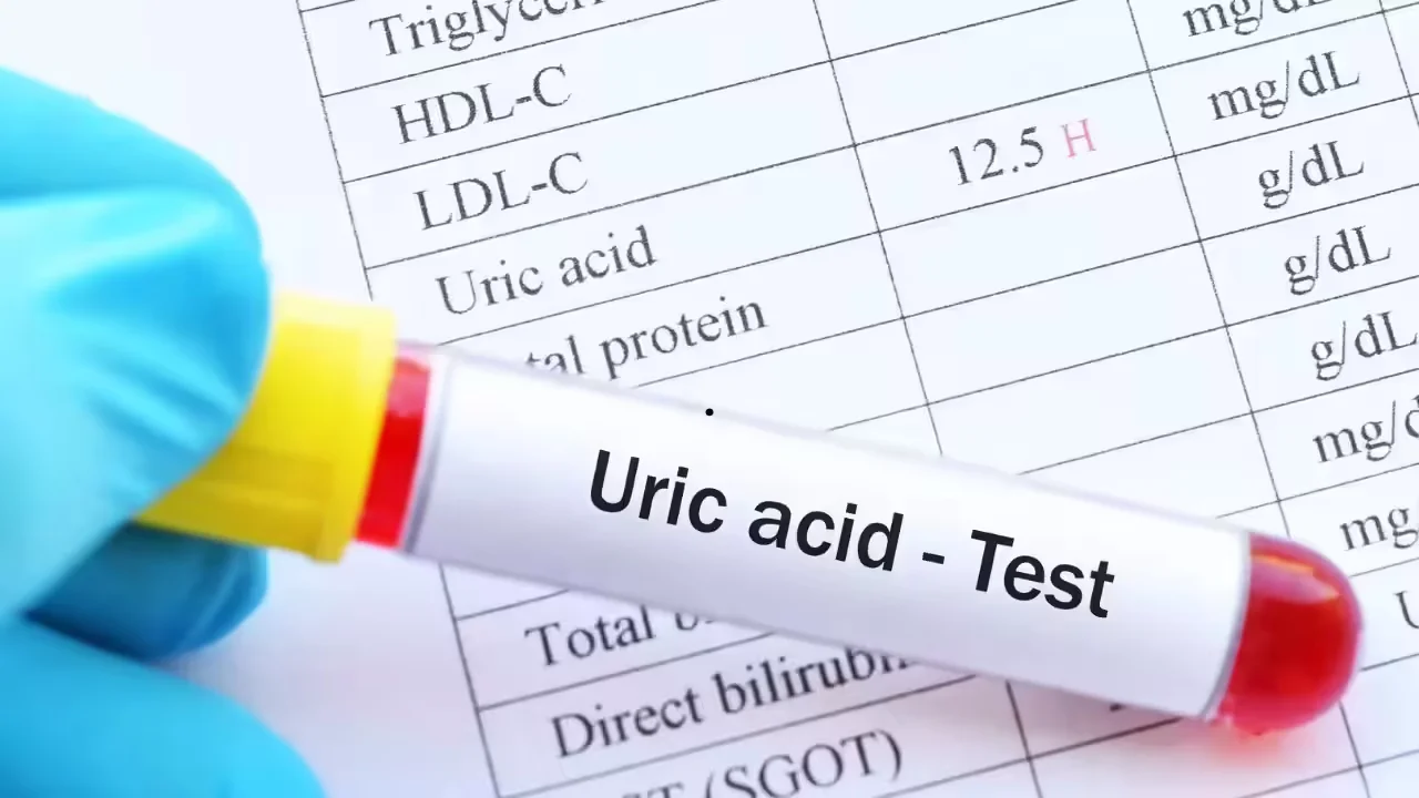 Featured image for Top 7 Foods to Quickly Reduce Uric Acid Levels
