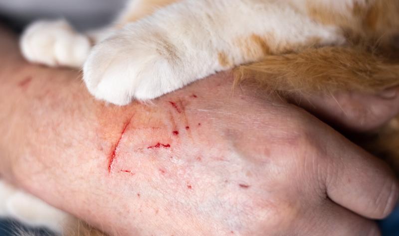 Featured image for "First Fatal Case of Alaskapox Virus Reported in Alaska"