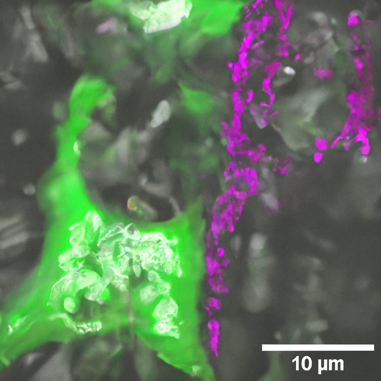 Featured image for "Unraveling the Denisovans' Genetic Legacy: Implications for Mental Health"