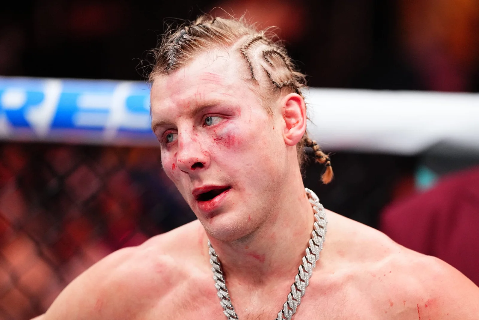 Pimblett Returns to Training After Eye-Poke, Targets Summer UFC Return