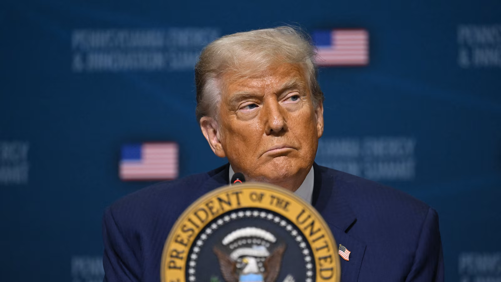 Featured image for Trump's Diagnosis of Chronic Venous Insufficiency and Leg Swelling