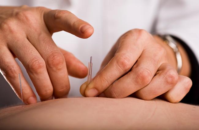 Featured image for Natural and Acupuncture Treatments Proven Effective for Chronic Low Back Pain in Older Adults