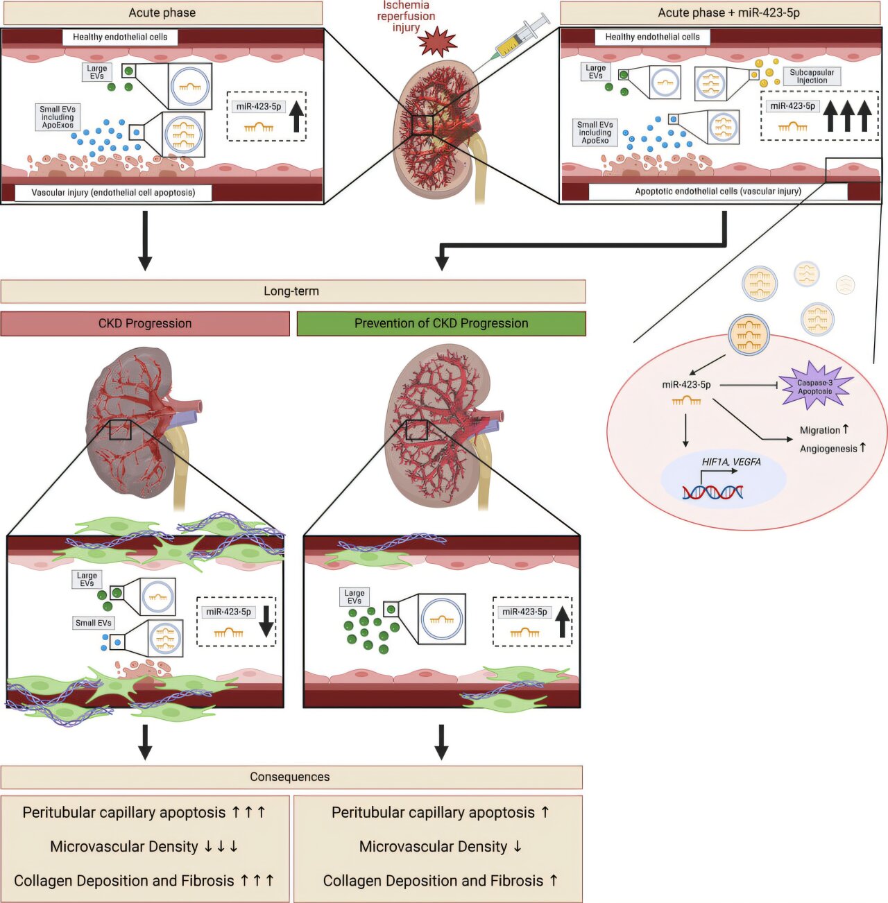 Featured image for Key Biomarker Identified for Chronic Renal Failure