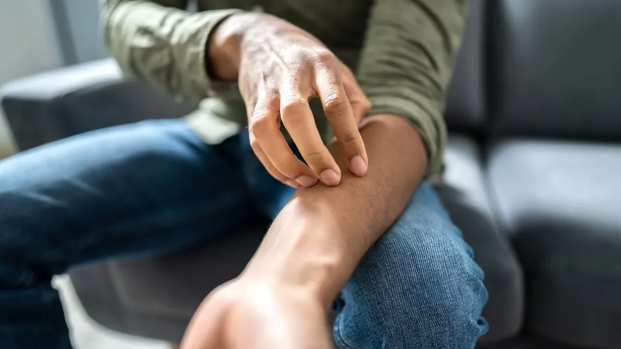 Minnesota braces for sexually transmitted fungal outbreak linked to TMVII