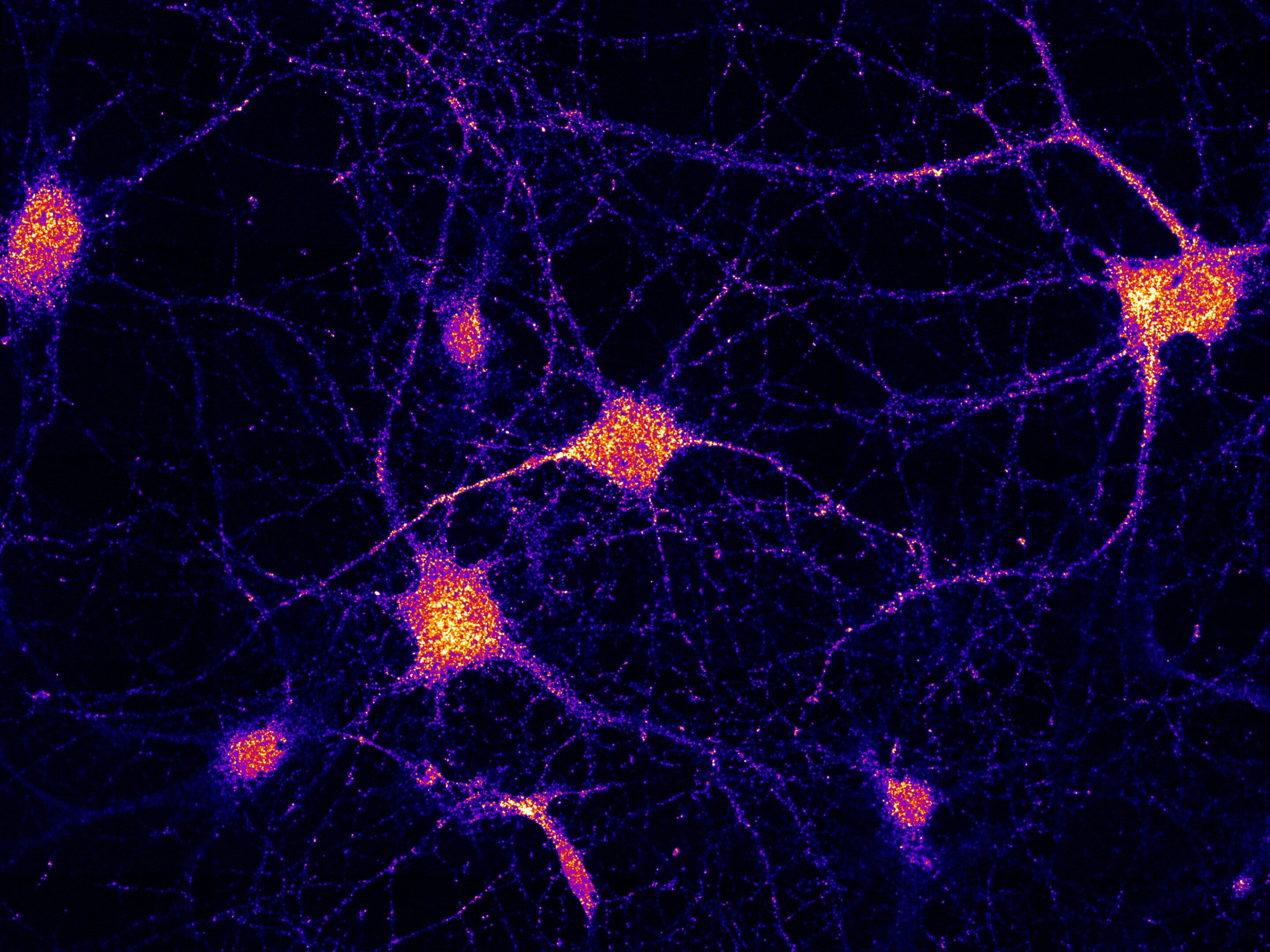 Featured image for Discovery of Missing Link in mRNA Delivery to Brain Cells.
