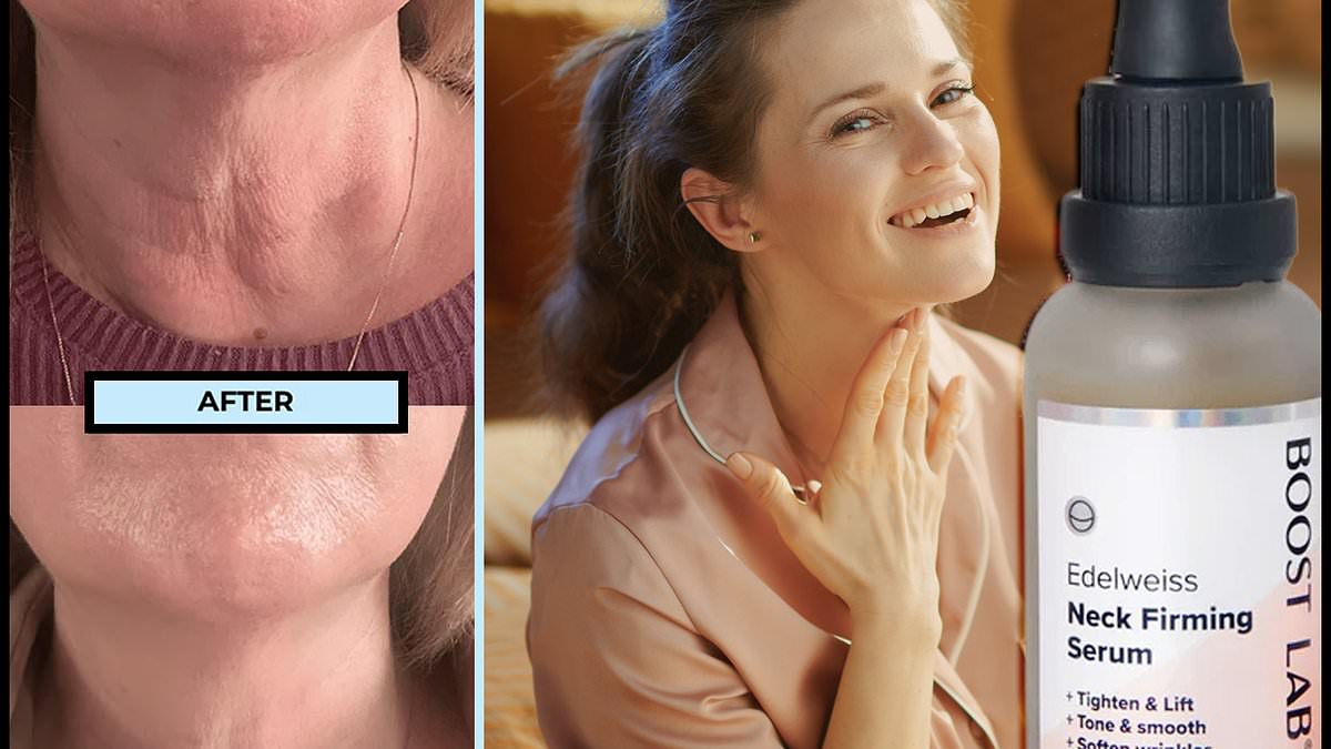 Featured image for "Say Farewell to Turkey Neck with This Affordable Firming Neck Serum for Smooth, Wrinkle-Free Skin"