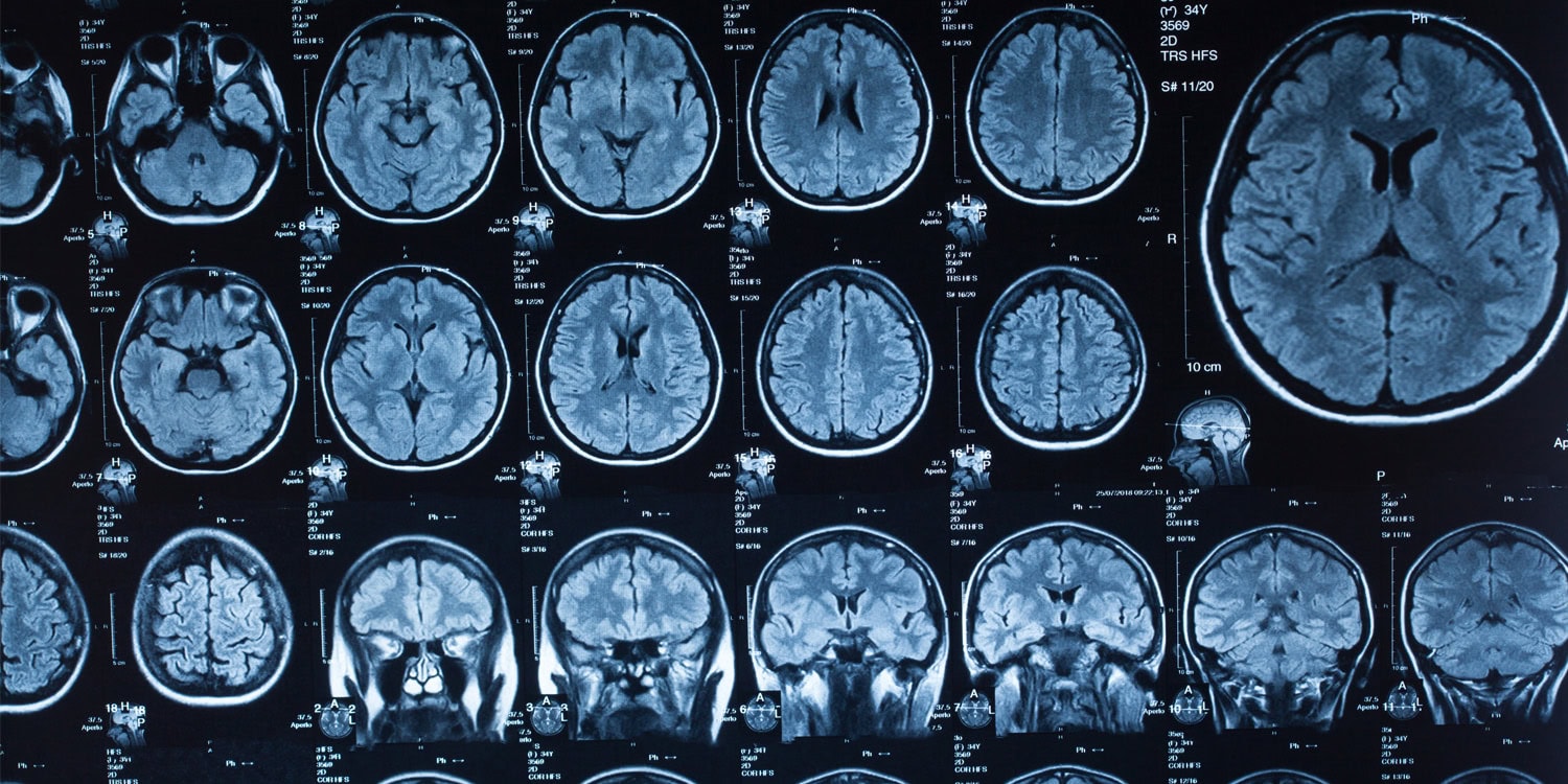 Featured image for Extreme Political Ideologies Show Similar Brain Activity