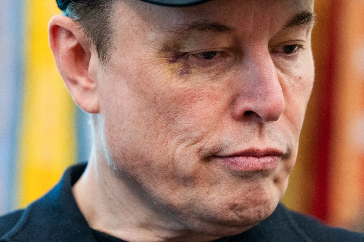 Featured image for Elon Musk's Black Eye and Controversies Spark Attention