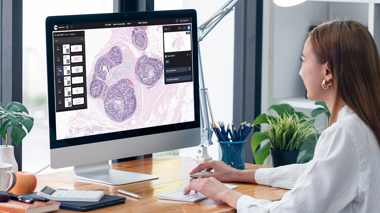 Featured image for Revolutionizing Cancer Care: AI Predicts Diagnosis, Treatment, and Survival.