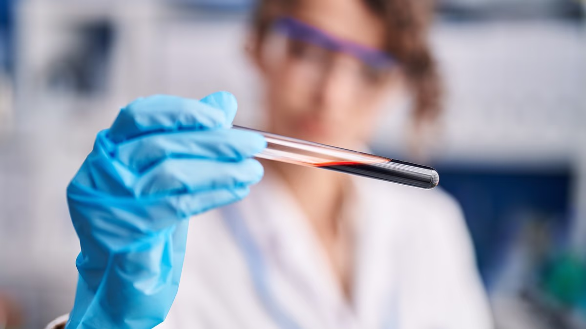 New Blood Test Predicts Rapid Alzheimer's Progression