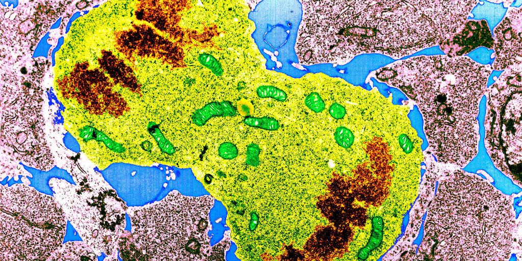 Featured image for Uncovering the Key Factors Behind Women's Higher Risk of Autoimmune Diseases