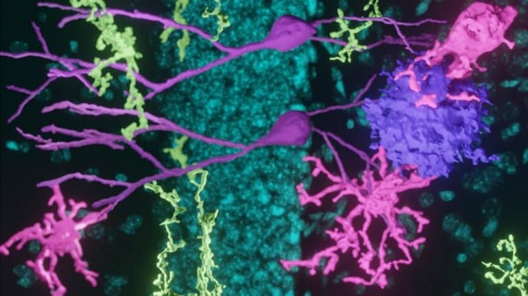 Revolutionary Peptide Restores Memory and Mood in Alzheimer's Patients.