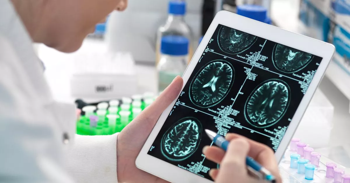 New Study Reveals Surprising Early Sign of Alzheimer's: Walking Difficulties