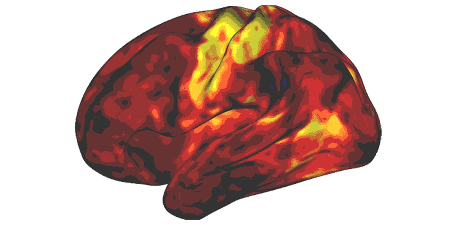 Featured image for New Research Shows ADHD Medications Mimic Sleep, Not Attention Control