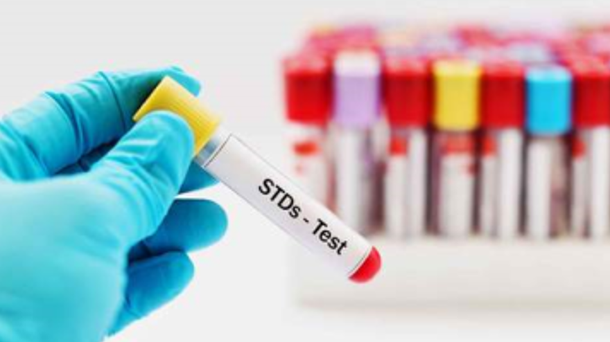 Featured image for Syphilis Cases on the Rise in Multiple States