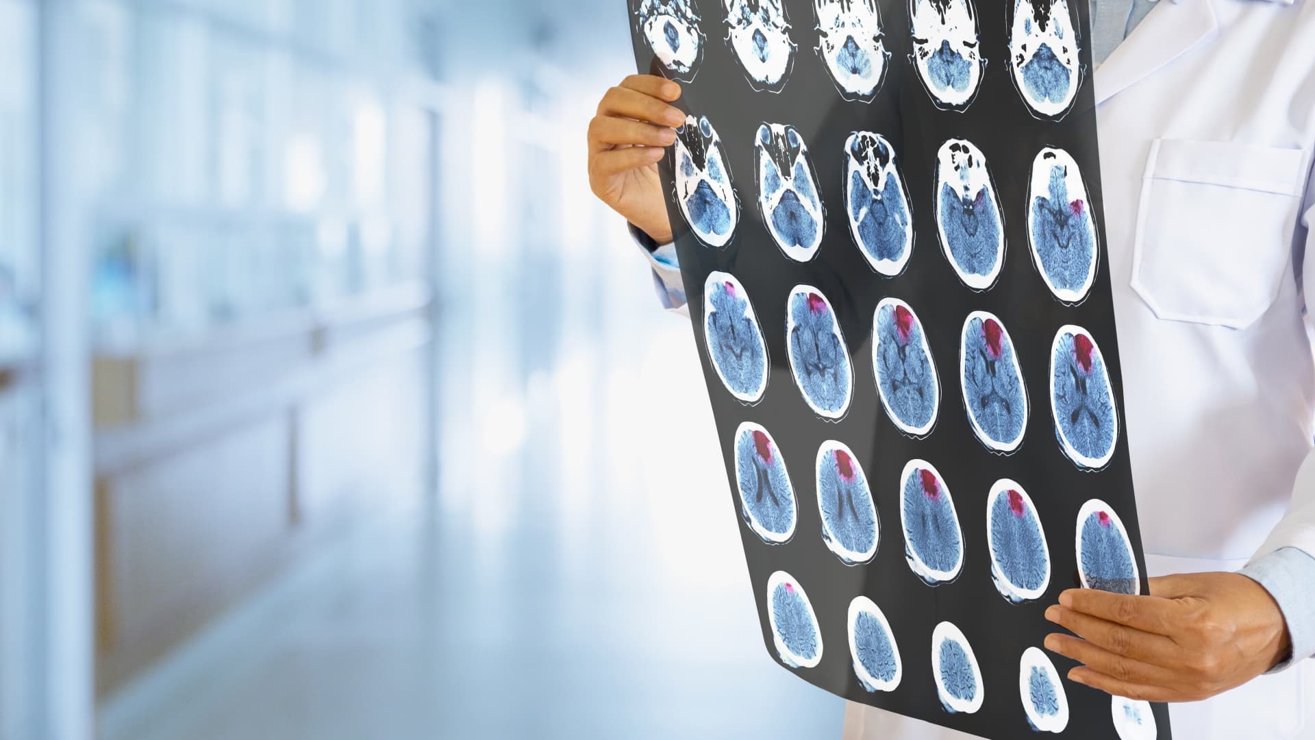 "Promising Experimental Vaccines for Aggressive Brain Tumors and Pancreatic Cancer"